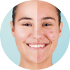 Controls excess oil and prevents acne with Tea Tree Essential Oil.